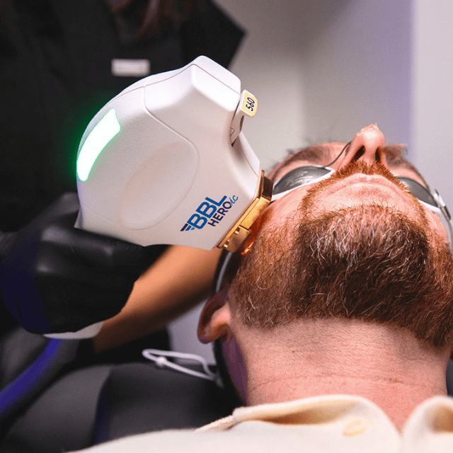 Ottawa Derm Surgery Centre BBL HEROic Tech