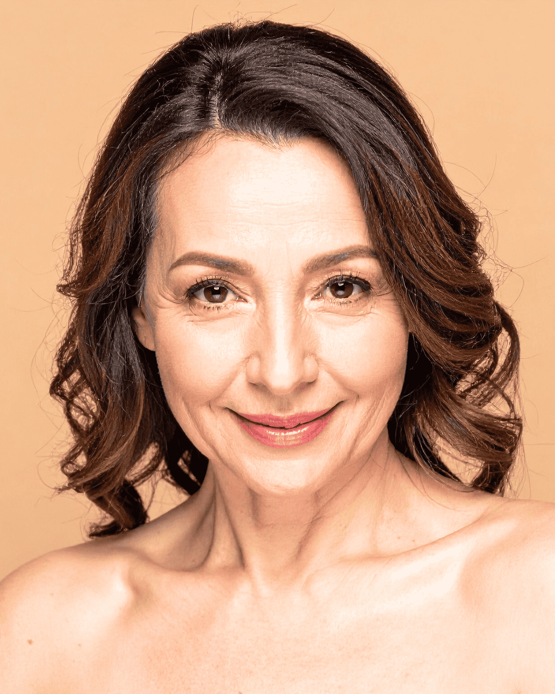 Ottawa Derm Surgery Centre Cosmetic Conditions Melasma