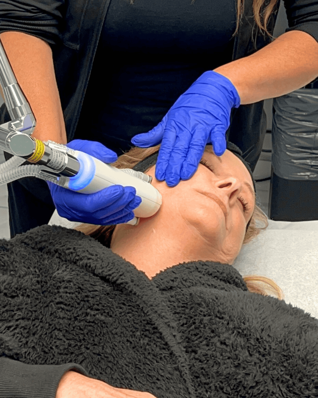Ottawa Derm Surgery Centre Cosmetic Dermatology Skin Resurfacing
