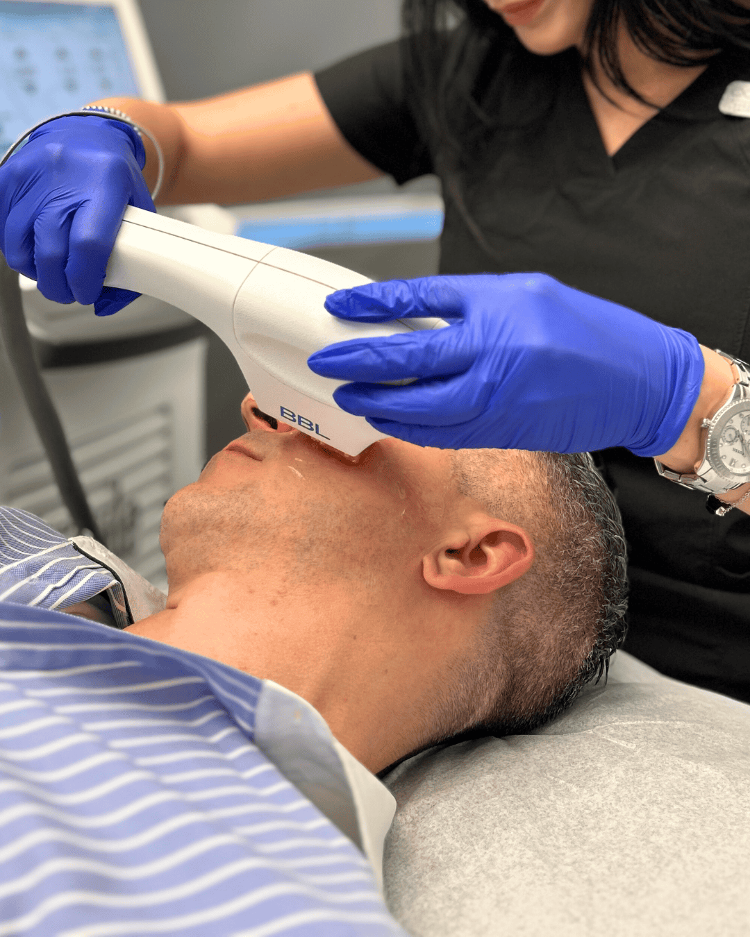 Ottawa Derm Surgery Centre Cosmetic Treatments BBL