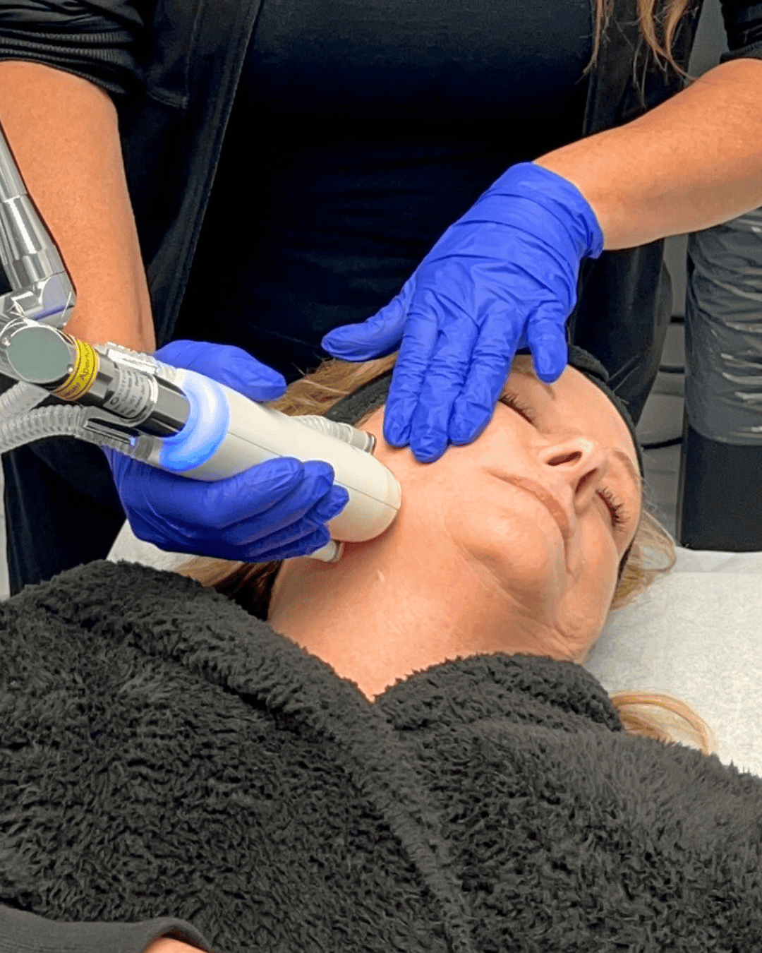Ottawa Derm Surgery Centre Cosmetic Treatments HALO