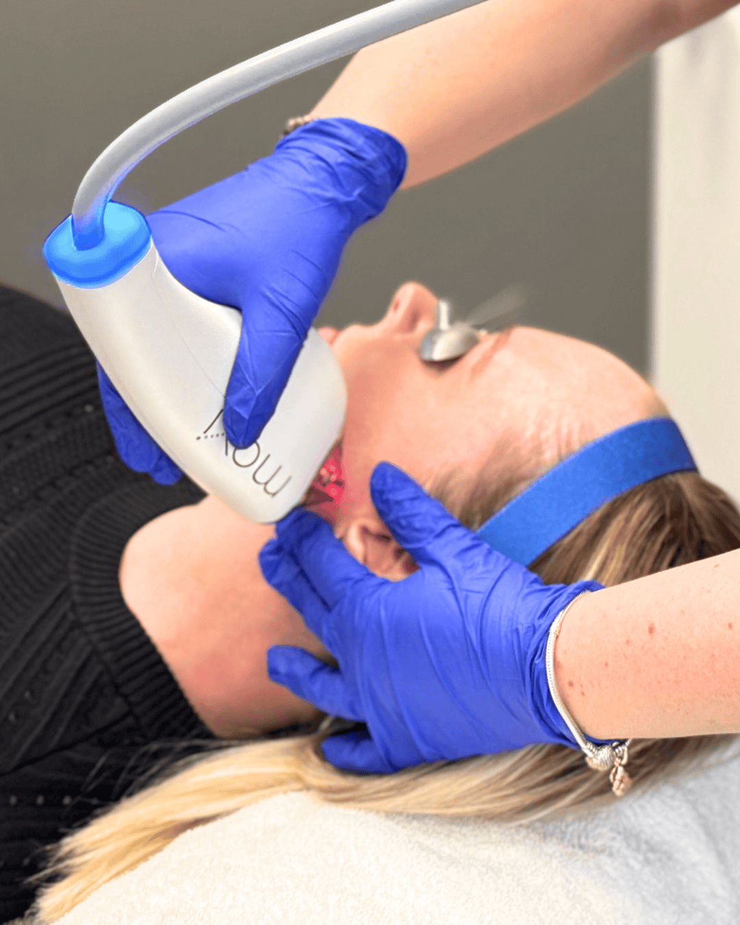 Ottawa Derm Surgery Centre Cosmetic Treatments MOXI