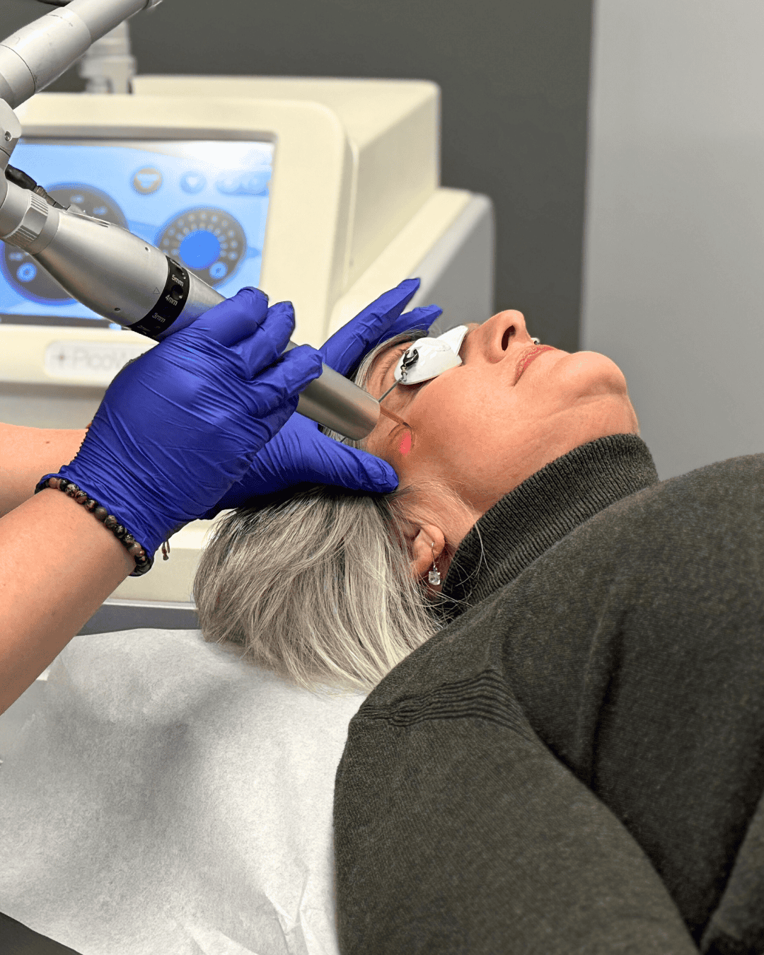 Ottawa Derm Surgery Centre Cosmetic Treatments PicoWay