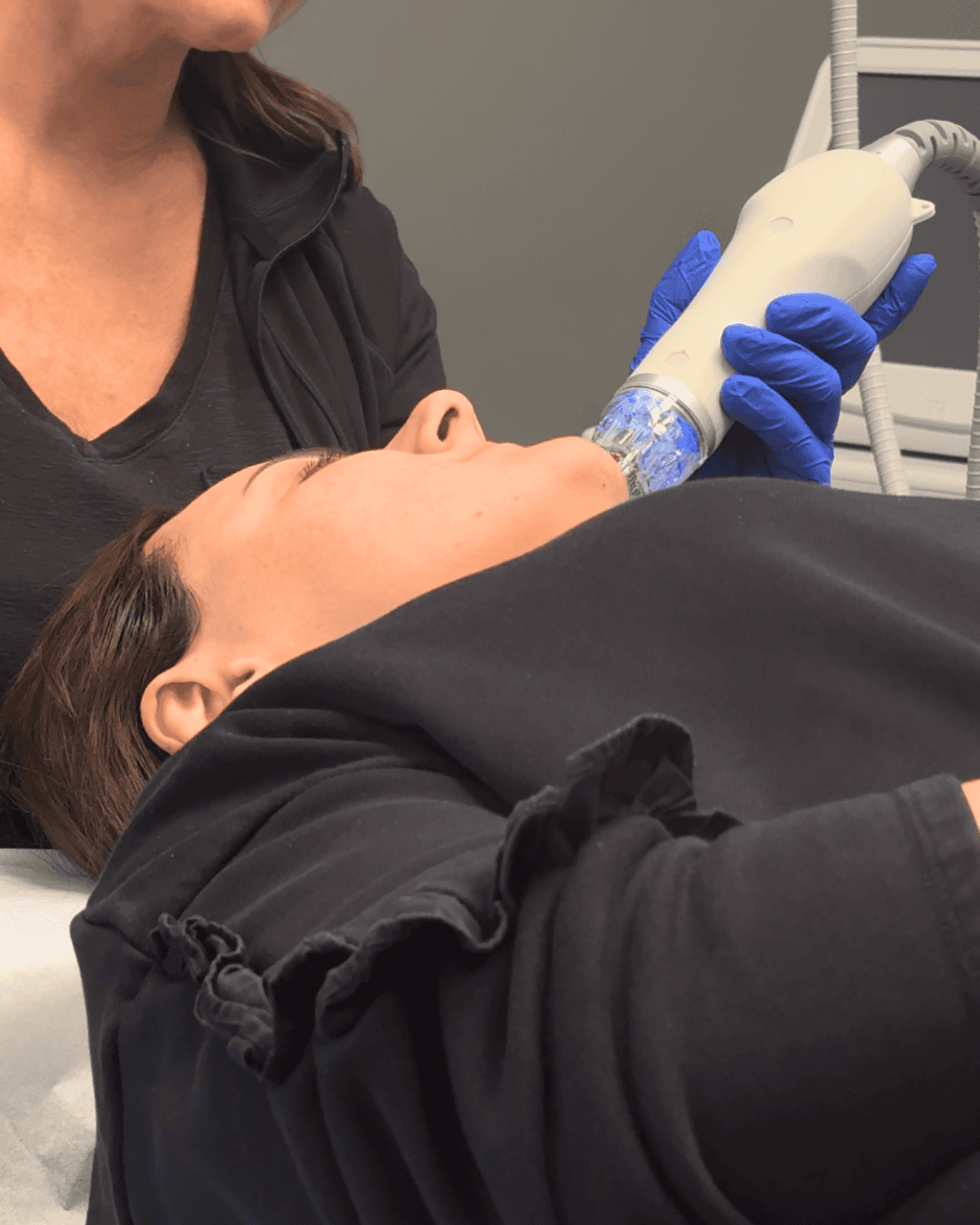Ottawa Derm Surgery Centre Cosmetic Treatments Secret RF