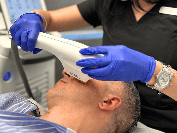 Ottawa Derm Surgery Centre BBL Face Package of 5