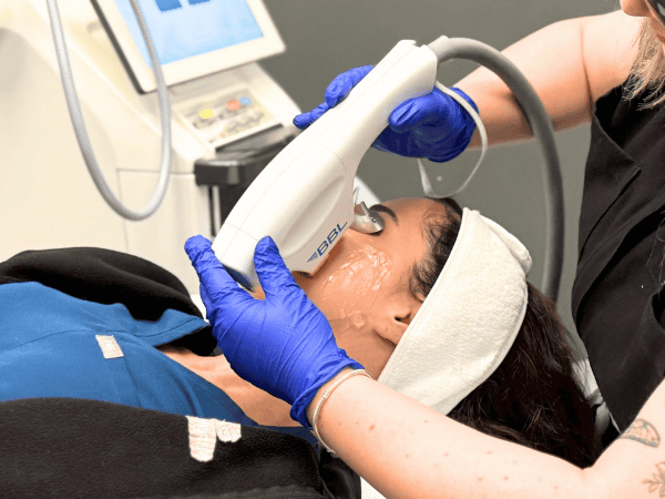 Ottawa Derm Surgery Centre BBL Package Special Offers