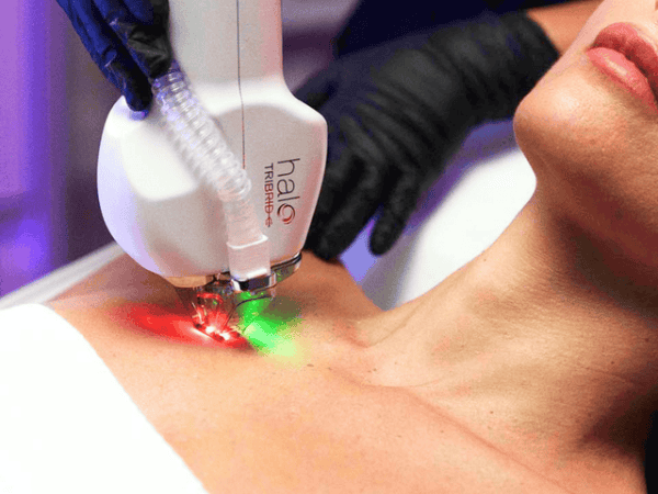 Ottawa Derm Surgery Centre HALO Tribid Special Offers