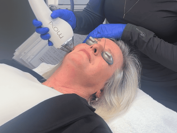 Ottawa Derm Surgery Centre MOXI Face Special Offers